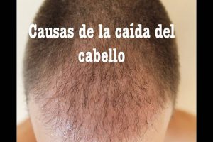 causas-caida-cabello
