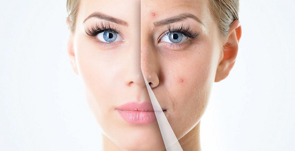 peeling facial