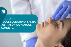 que es una rinoplastia ultrasonica medicina estetica valencia