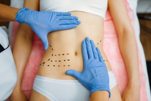 Tipos de abdominoplastia
