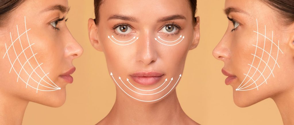 Lifting cervico facial