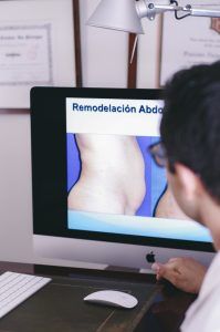 Doctor con liposucción
